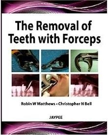 The Removal of Teeth with Forceps