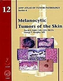 Melanocytic Tumors Of The Skin 12 "AFIP Atlas Of Tumor Pathology Series 4"