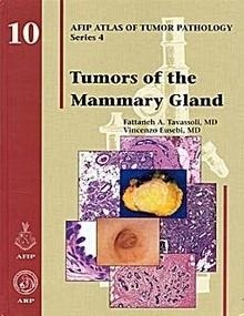 Tumors Of The Mammary Gland 10 "AFIP Atlas Of Tumor Pathology Series 4"