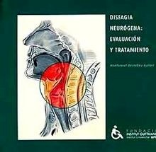Disfagia Neurógena: Evaluación y Tratamiento