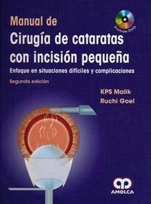 Manual de Cirugia de Cataratas con Incision Pequeña "Enfoque en Situaciones Dificiles y Complicaciones + Dvd"