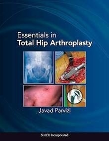 Essentials In Total Hip Arthroplasty