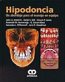 Hipodoncia "Un Abordaje para el Manejo en Equipo"