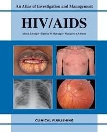 HIV/AIDS: Atlas of Investigation and Management