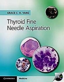 Thyroid Fine Needle Aspiration + CD