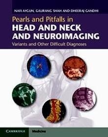 Pearls and Pitfalls in Head and Neck and Neuroimaging "Variants and Other Difficult Diagnose"