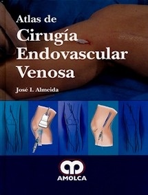 Atlas de Cirugia Endovascular Venosa