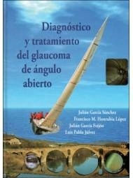 Diagnóstico y Tratamiento del Glaucoma de Ángulo Abierto