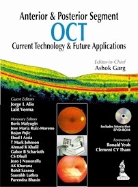 Anterior & Posterior Segment OCT "Current Technology & Future Applications"