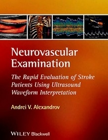 Neurovascular Examination "The Rapid Evaluation of Stroke Patients Using Ultrasound Waveform Interpretation"