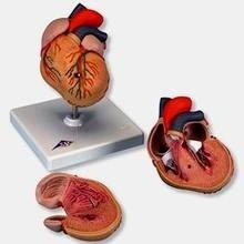 Corazón Clásico con Hipertrofia Ventricular Izquierda (HVI), de 2 piezas