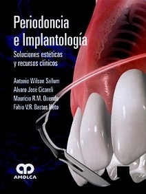 Periodoncia e Implantología "Soluciones Esteticas y Recursos Clinicos"