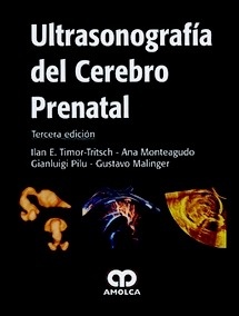 Ultrasonografía del Cerebro Prenatal