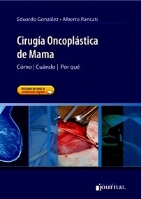 Cirugía Oncoplástica de Mama "Cómo - Cuándo - por que"
