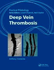 Deep Vein Thrombosis "Practical Phlebology"