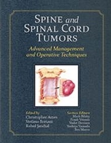 Spine and Spinal Cord Tumors "Advanced Management and Operative Techniques. BOOK + DVD"