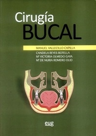 Cirugía Bucal
