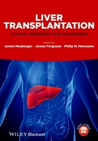 Liver Transplantation "Clinical Assessment and Management"
