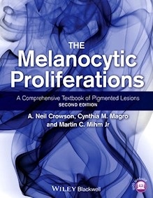 The Melanocytic Proliferations "A Comprehensive Textbook of Pigmented Lesions"