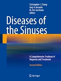 Diseases of the Sinuses "A Comprehensive Textbook of Diagnosis and Treatment"