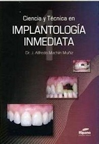 Ciencia y Técnica en Implantología Inmediata (2 Tomos)