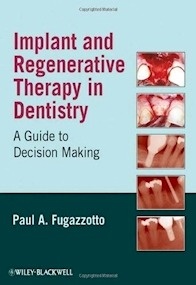 Implant And Regenerative Therapy In Dentistry "A Guide To Decision Making"