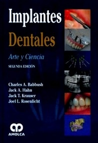 Implantes Dentales "Arte y Ciencia"
