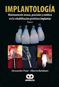 Implantologìa 2 Vols. "Mínimamente Invasiva, Precisión y Estética en la Rehabilitación Protésica"