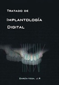 Tratado de Implantología Digital