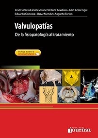 Valvulopatías "De la Fisiopatología al Tratamiento"