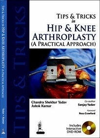 Tips And Tricks In Hip And Knee Arthroplasty "A Practical Approach"