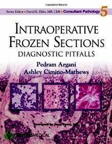 Intraoperative Frozen Sections "Diagnostic Pitfalls"
