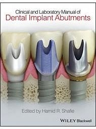 Clinical And Laboratory Manual Of Dental Implant Abutments