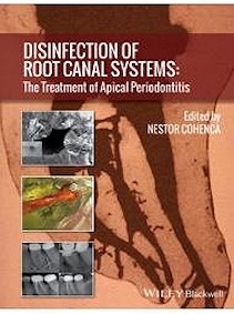 Disinfection Of Root Canal Systems "The Treatment Of Apical Periodontitis"