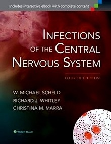 Infections Of The Central Nervous System