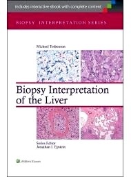 Biopsy Interpretation Of The Liver