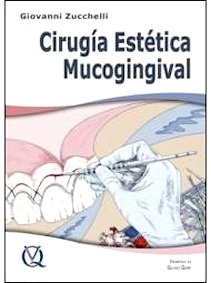 Cirugía Estética Mucogingival