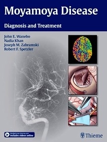 Moyamoya Disease "Diagnosis and Treatment"
