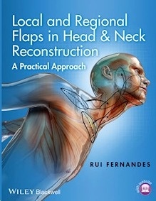 Local and Regional Flaps in Head & Neck Reconstruction "A Practical Approach"