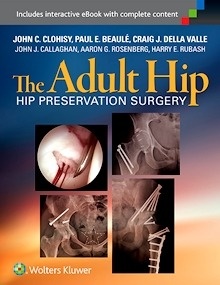 The Adult Hip "Hip Preservation Surgery"