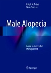 Male Alopecia "Guide to Successful Management"