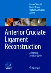 Anterior Cruciate Ligament Reconstruction "A Practical Surgical Guide"