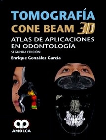 Tomografia Cone Beam 3D "Atlas de Aplicaciones en Odontología"