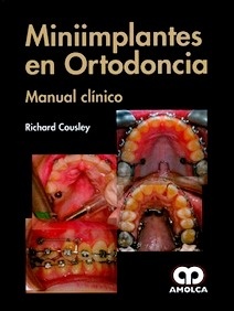 Miniimplantes en Ortodoncia "Manual Clínico"