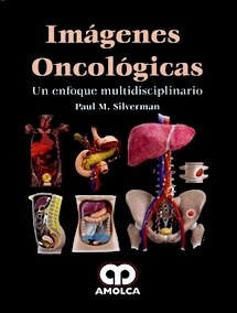 Imagenes Oncológicas "Un Enfoque Multidisciplinario"