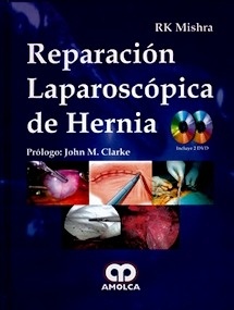 Reparación Laparoscópica de Hernia + 2 DVDs