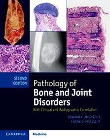 Pathology of Bone and Joint Disorders Print and Online Bundle "With Clinical and Radiographic Correlation"