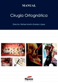 Manual de Cirugía Ortognática
