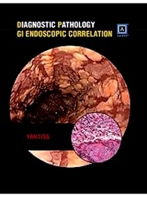 Diagnostic Pathology: Gi Endoscopic Correlations