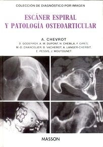 Escaner Espiral y Patologia Osteoarticular